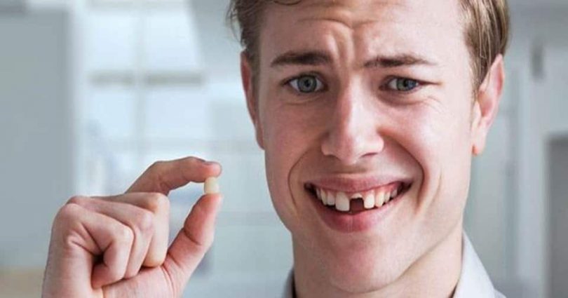 تفسير حلم سقوط الاسنان في اليد