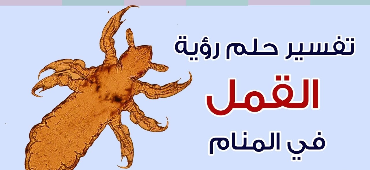 تفسير حلم القمل في الشعر للعزباء لإبن سيرين والنابلسي