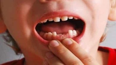 تفسير سقوط الاسنان في المنام