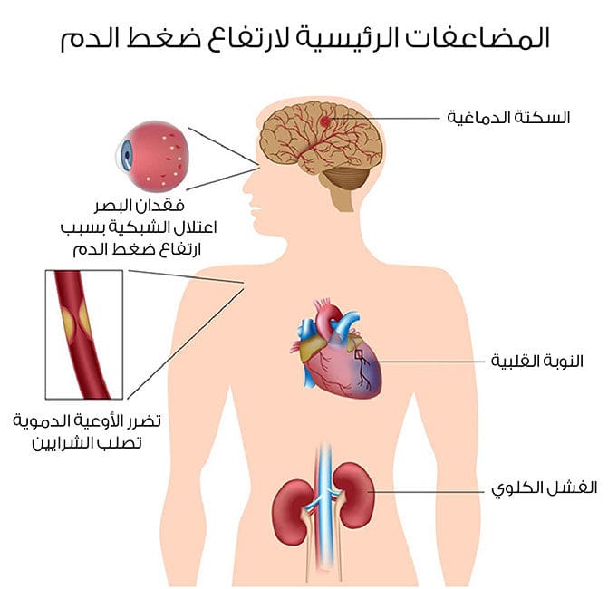 مضاعفات ارتفاع ضغط الدم