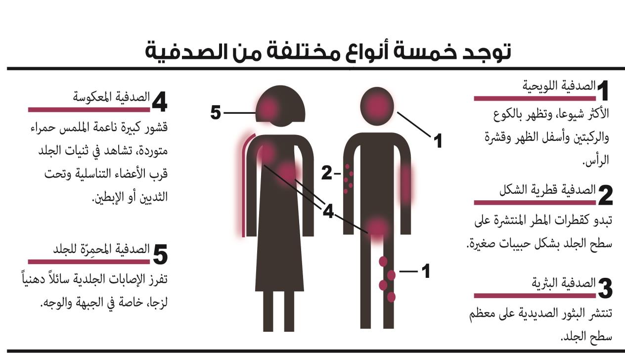 التهاب الجيوب الأنفية