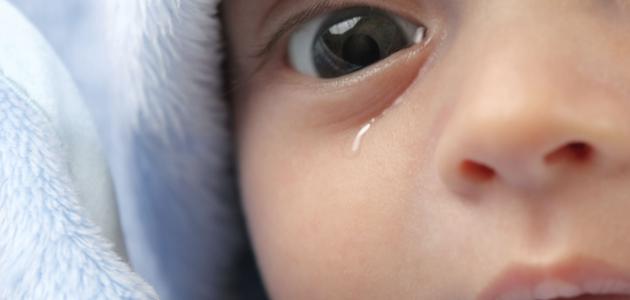 غالبا ما يولد الاطفال بانسداد في القنوات الدمعية