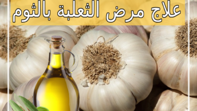 علاج مرض الثعلبة بالثوم