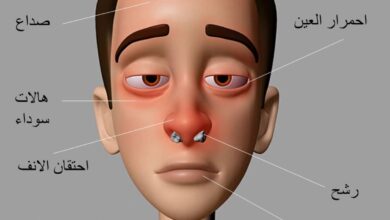 أعراض الجيوب الأنفية