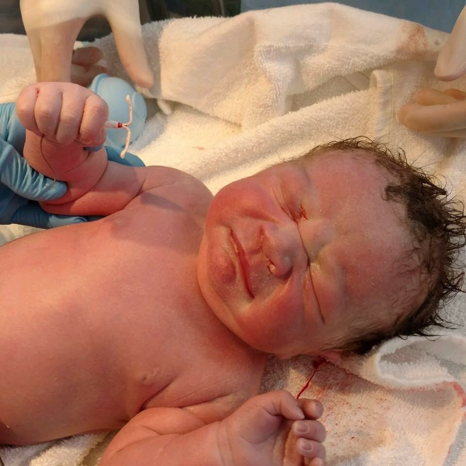 طفل بعد ولادته.