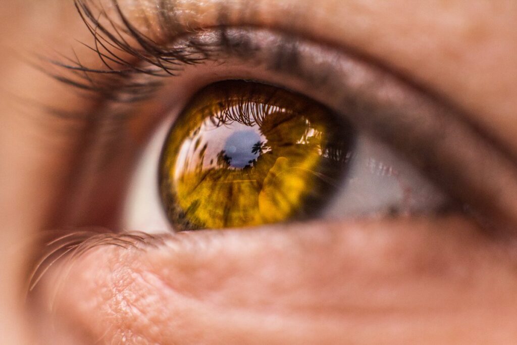 ما سبب اصفرار العين وأعراضها وتشخيصها وعلاجها