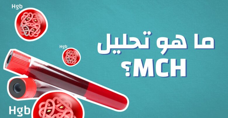 معلومات عن تحليل mch