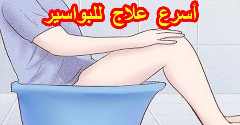 أسرع علاج للبواسير