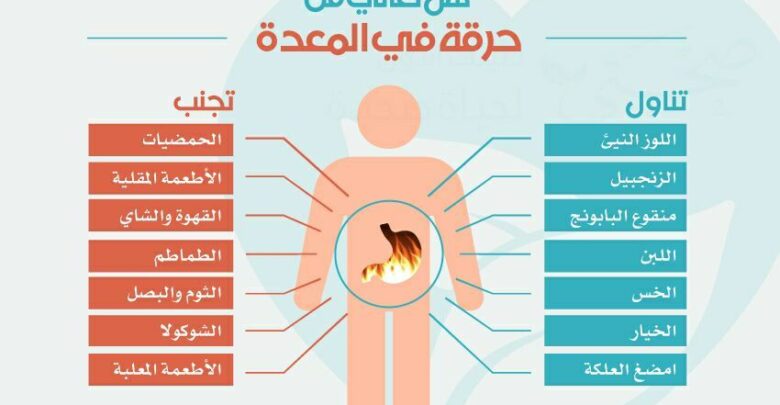 أسباب حرقة المعدة