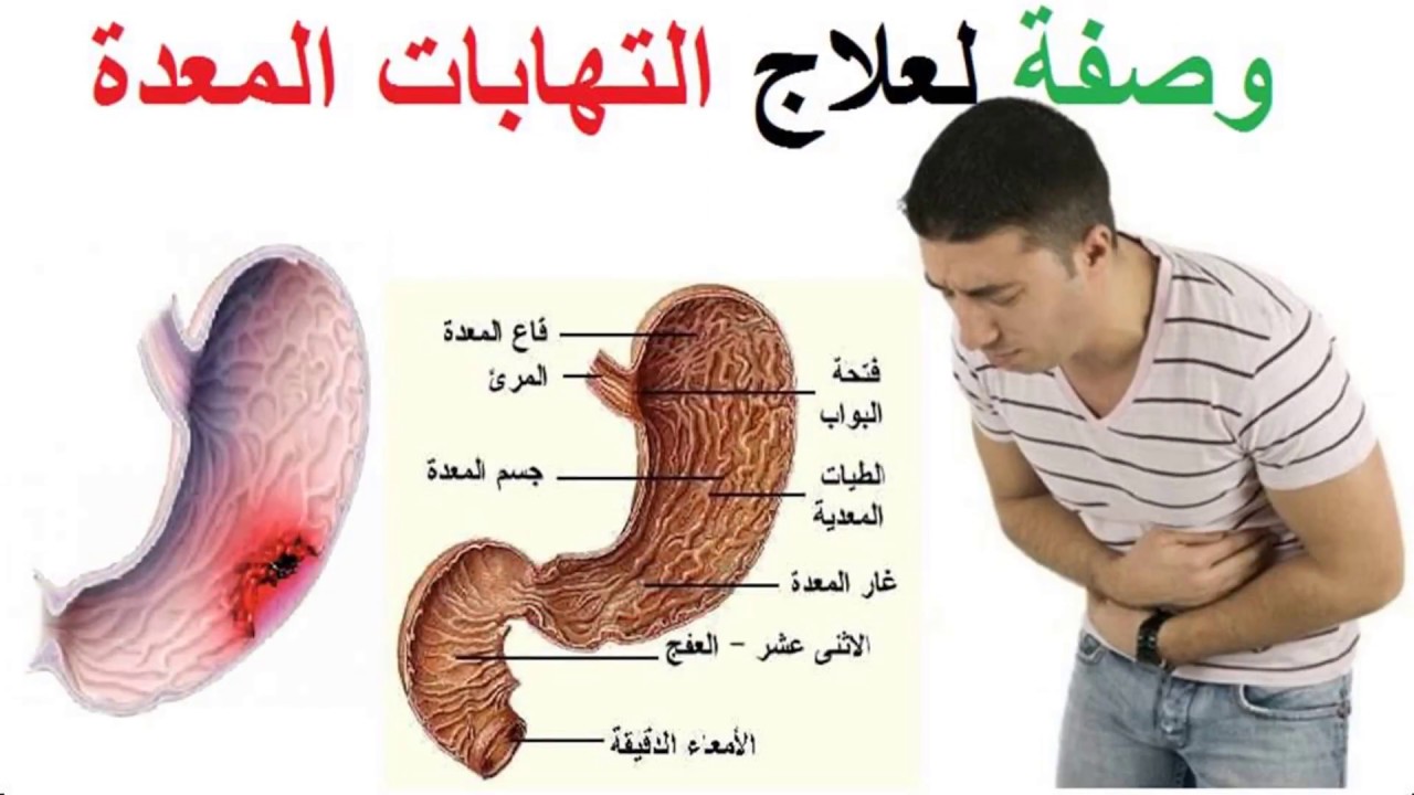 وصفة لعلاج التهاب المعدة