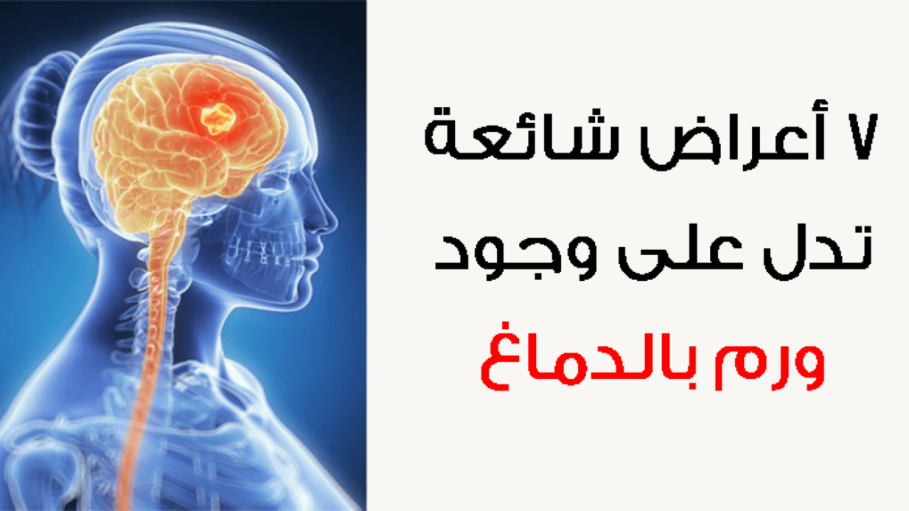 ورم بالدماغ