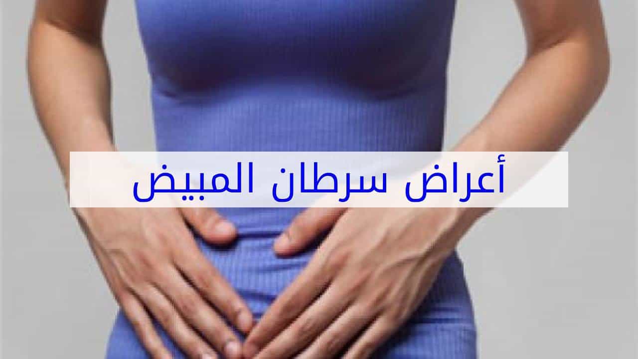 أعراض سرطان المبيض