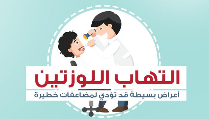 التهاب اللوزتين