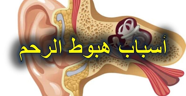 أسباب هبوط الرحم