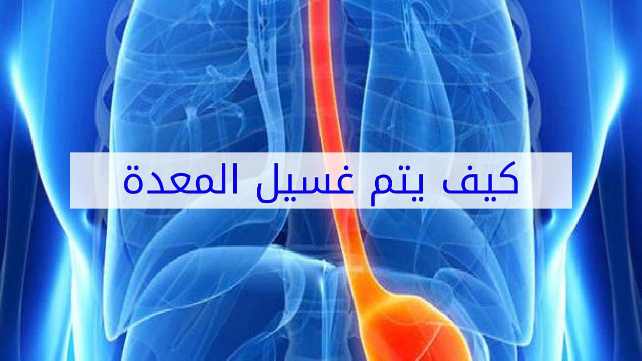 كيف يتم غسيل المعدة