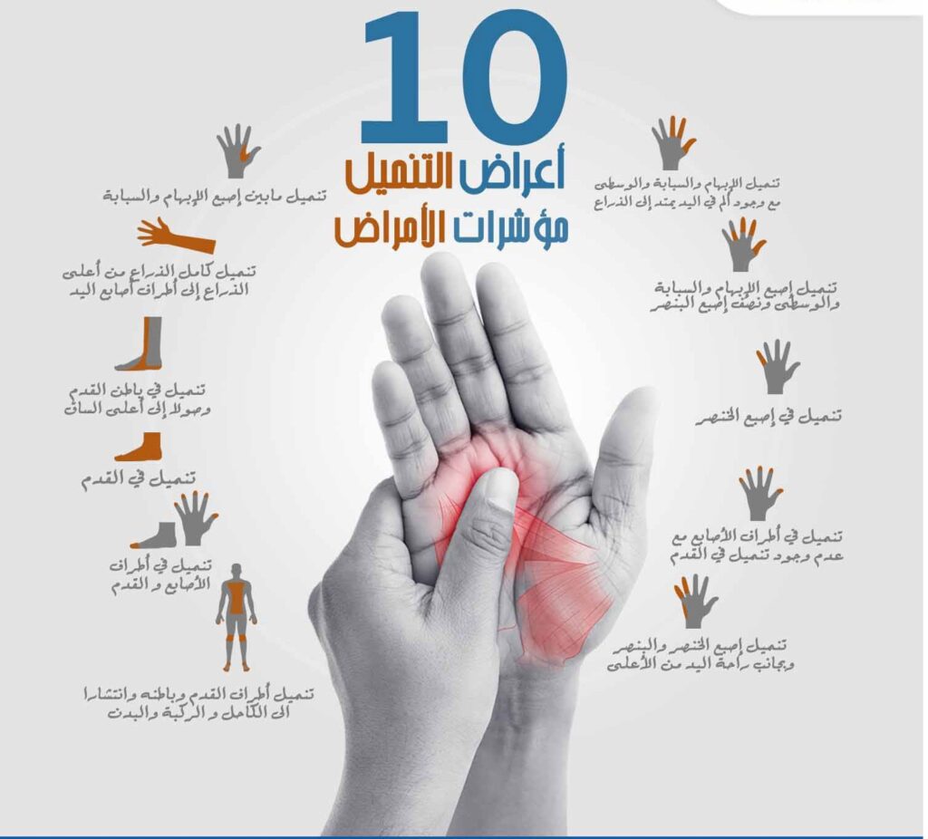 الم باطن الرجل