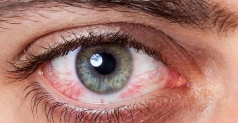 عين مصابة باعتلال الشبكية