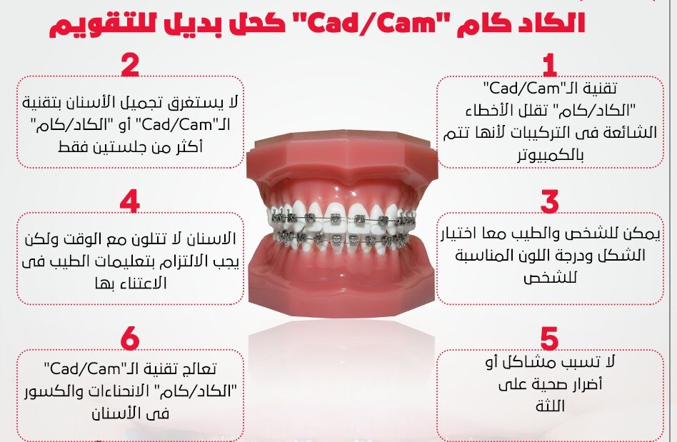 6 معلومات عن تقويم الأسنان