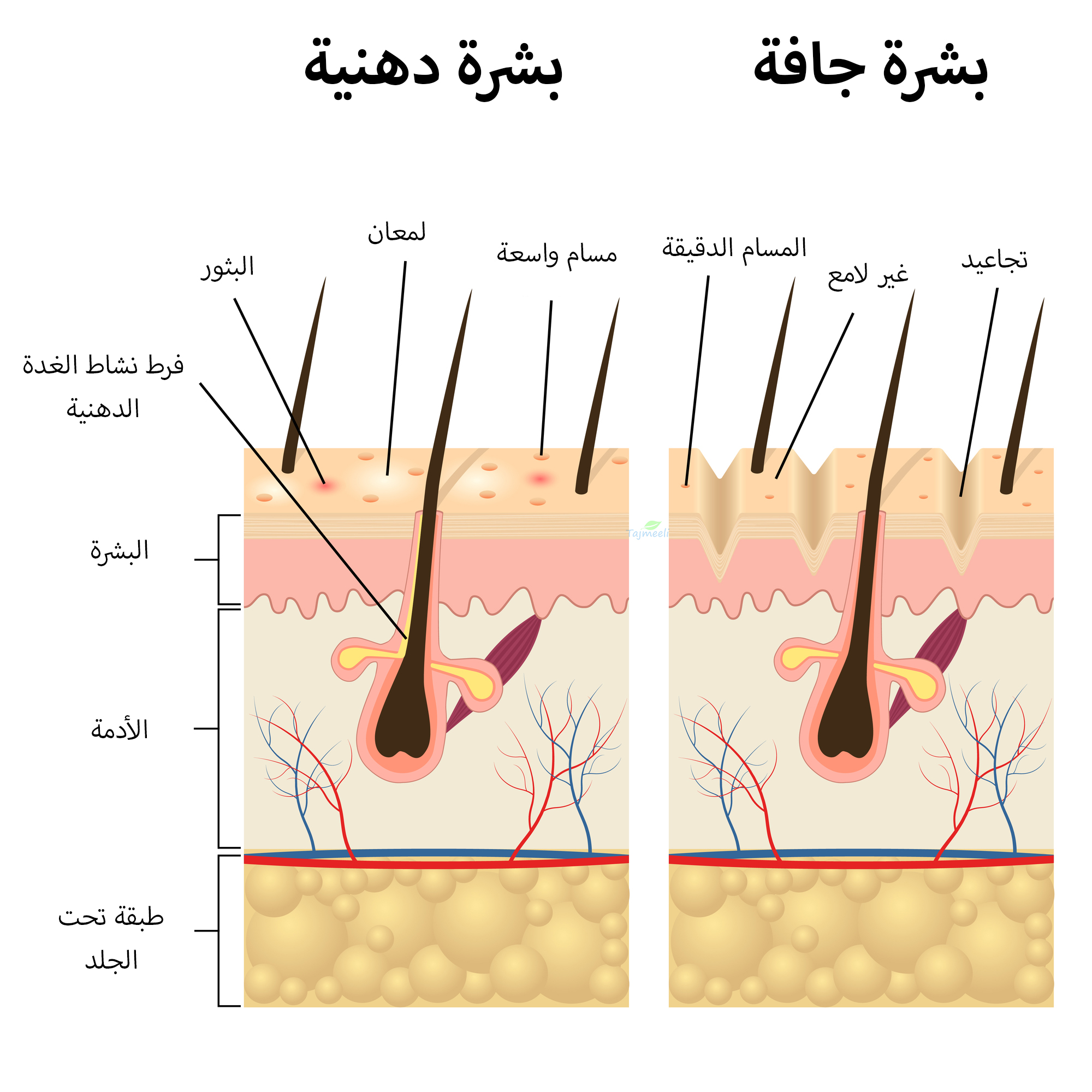 البشرة الجافة