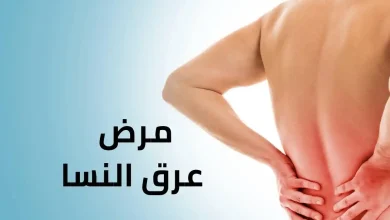 مرض عرق النسا وعلاجه