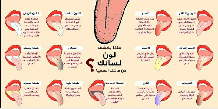 امراض اللسان