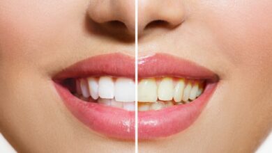 طريقة تنظيف الاسنان من الاصفرار والحفاظ عليها بيضاء