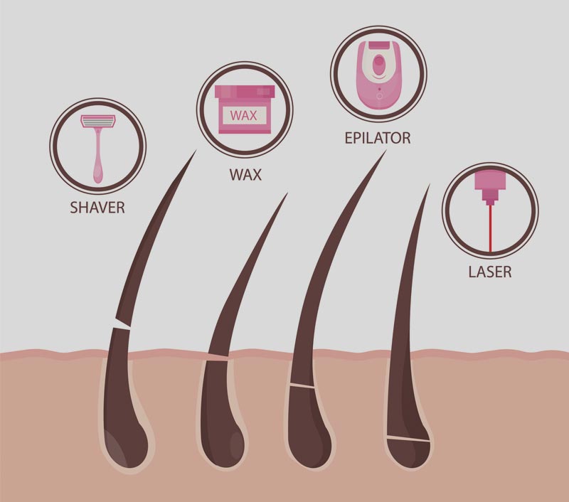 أدوات إزالة الشعر 