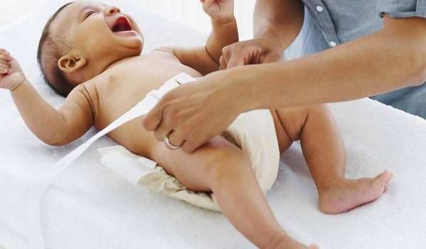 علاج حصر البول عند الأطفال الرضع