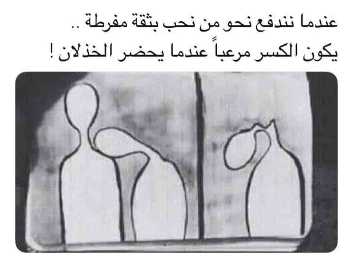 عندما نندفع نحو من نحب