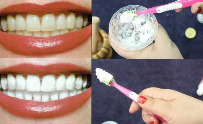 طريقة لتبيض الأسنان