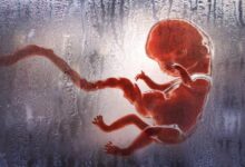 متى يتوقف الدم بعد الإجهاض بدون تنظيف وما هي المخاطر ؟