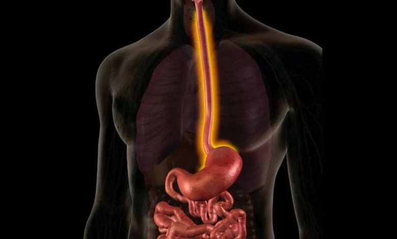تجربتي مع التهاب المريء .. نصائح لعلاج التهاب المريء