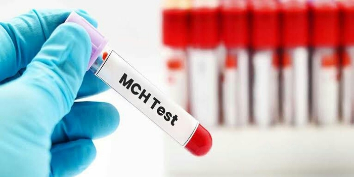 ما هو تحليل mchc؟ 5 طرق الاستعداد لاختبار الدم MCHC